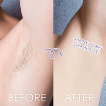 Load image into Gallery viewer, TOUCH™ - Perfect Hair Remover - Remove Hair Instantly and Painlessly