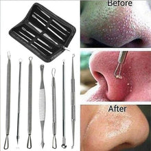 Load image into Gallery viewer, Pimple Popper Kit
