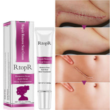 Load image into Gallery viewer, RtopR Scar Remover Cream For Stretch Marks, Acne And More!