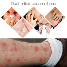 Load image into Gallery viewer, 3/5Pcs Anti Mites Pads
