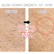 Load image into Gallery viewer, TOUCH™ - Perfect Hair Remover - Remove Hair Instantly and Painlessly
