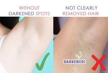 Load image into Gallery viewer, TOUCH™ - Perfect Hair Remover - Remove Hair Instantly and Painlessly
