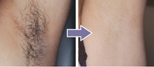 Load image into Gallery viewer, TOUCH™ - Perfect Hair Remover - Remove Hair Instantly and Painlessly
