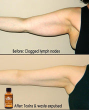 Load image into Gallery viewer, Lymphatic Drainage Ginger Oil
