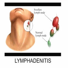 Load image into Gallery viewer, Neck Lymphatic Detox Patch (Set of 10)
