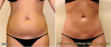 Load image into Gallery viewer, Lymphatic Drainage Ginger Oil
