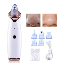 Load image into Gallery viewer, Blackhead Remover
