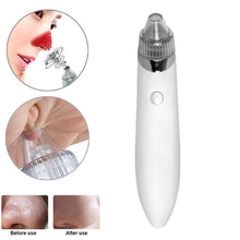 Load image into Gallery viewer, Blackhead Vacuum

