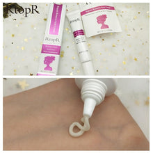 Load image into Gallery viewer, RtopR Scar Remover Cream For Stretch Marks, Acne And More!
