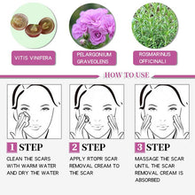 Load image into Gallery viewer, RtopR Scar Remover Cream For Stretch Marks, Acne And More!
