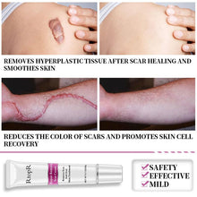 Load image into Gallery viewer, RtopR Scar Remover Cream For Stretch Marks, Acne And More!
